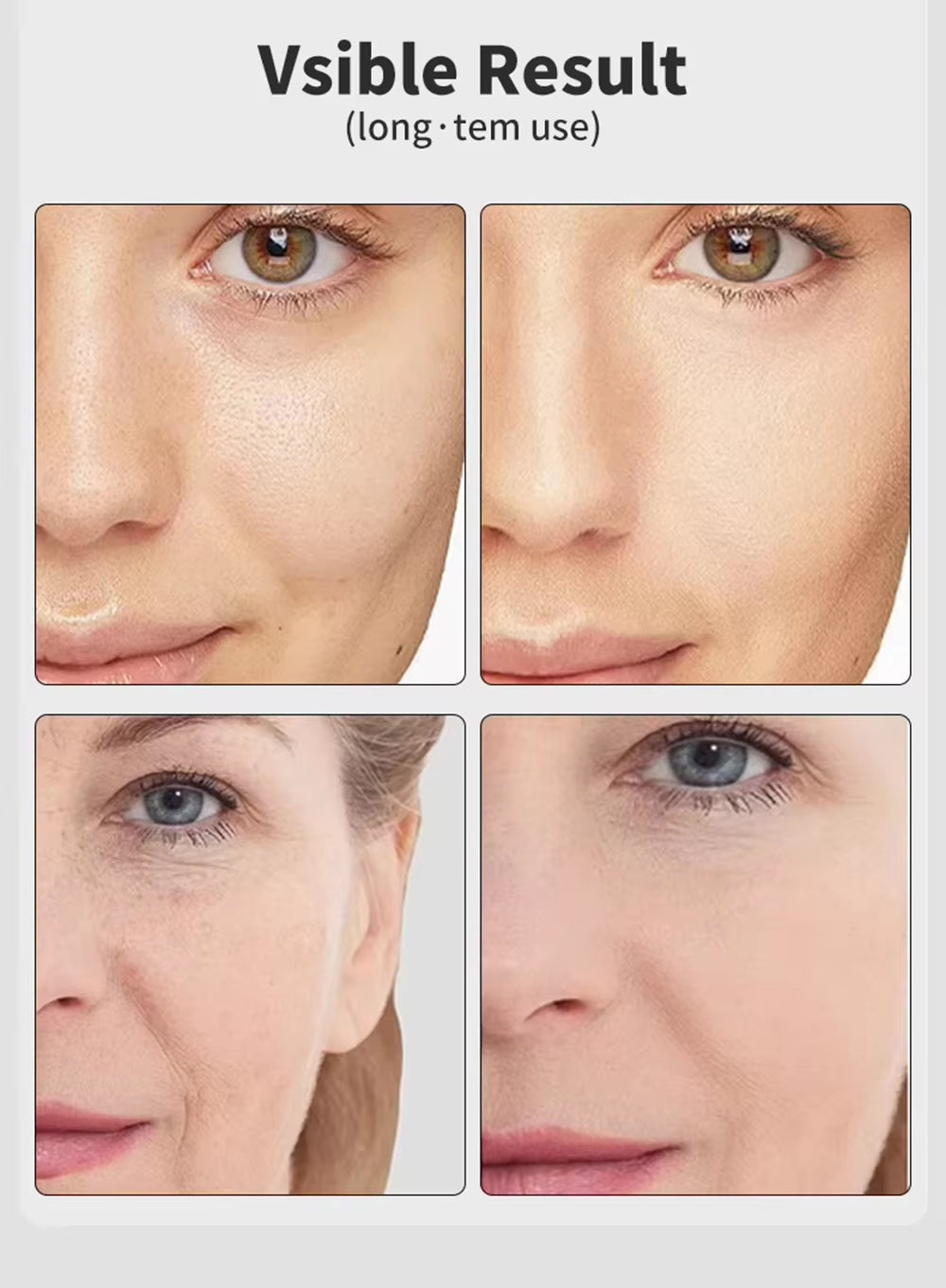 7 Colors EMS Microcurrent Facial Massager Age-R Booster Pro anti Wrinkle Lift Device Home Use Beauty Tool for Skin Care & Rejuve