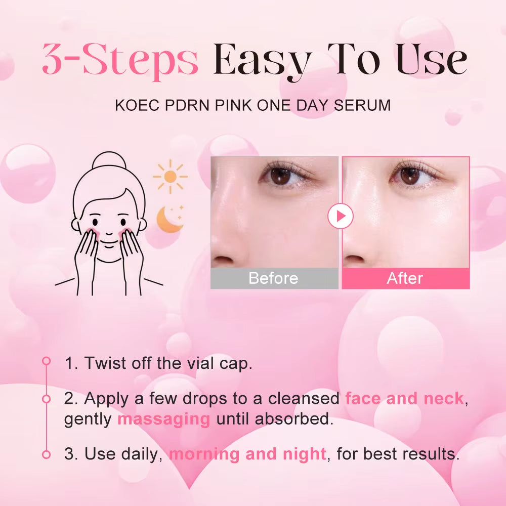 10Pcs KOEC PDRN Pink One Day Serum Hydrating Nourishing Smoothing Brightening Even Skin Tone Collagen Niacinamide Glutathion