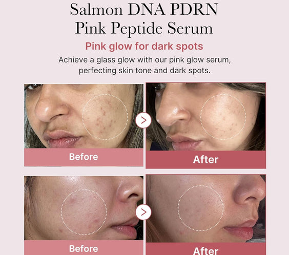 Salmon DNA PDRN Pink Peptide Serum, Pink Glow Serum, Peptide, Niacinamide, Hydrating & Moisturizing & Firming, Uneven Skin Tone, Korean Skincare | 1.01 Fl.Oz. (1.01 Fl.Oz., Salmon DNA PDRN)
